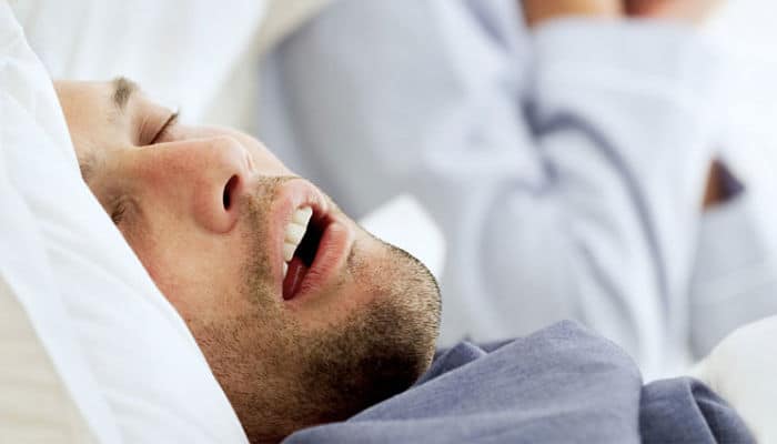 apnea obstructiva del sueño